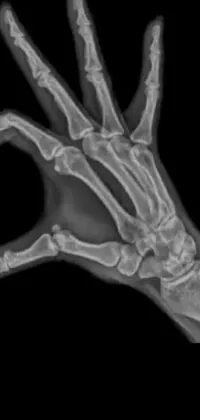 Gesture Bone Radiography Live Wallpaper