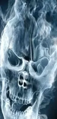Medical X-ray Neck Live Wallpaper