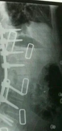This live wallpaper features an intriguing close-up x-ray image of a human neck