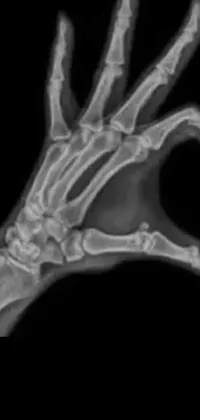 Radiography Gesture Medical Imaging Live Wallpaper